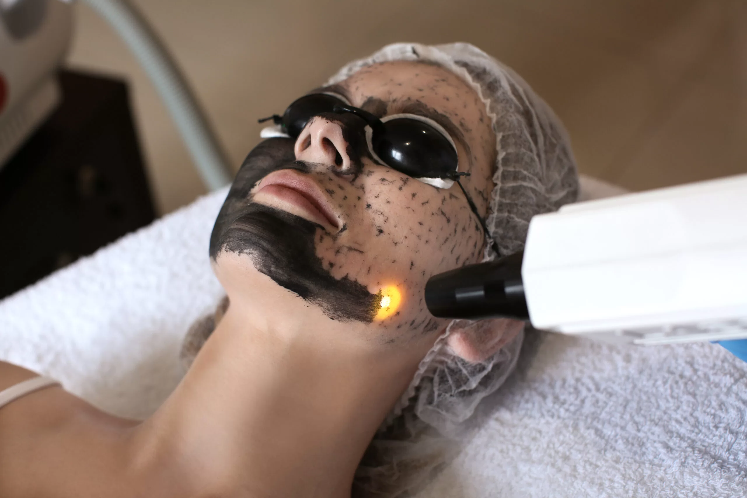 peeling