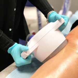 liposukcja kawitacyjna